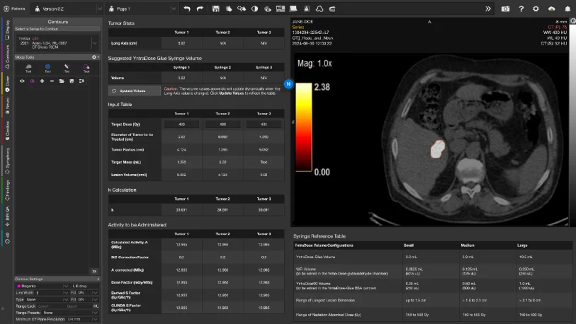 Finally, YntraDose-Guide is used to assess 90Y PET scans in order to quantify post-treatment dosimetry on a patient-by-patient basis