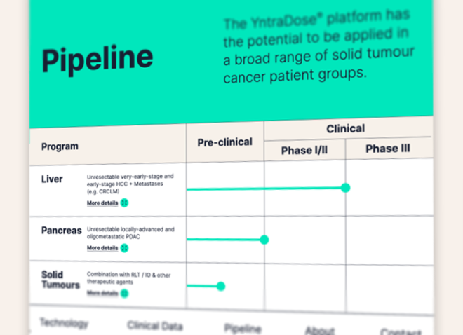 Screenshot of the Betaglue Pipeline page