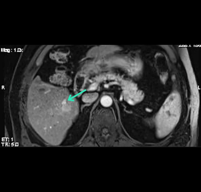 Diagnostic MRI Axial view
