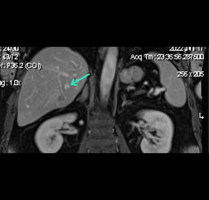 Diagnostic MRI Coronal view